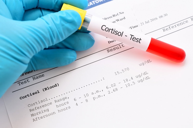 kortizol seviyesi kan testlerinde ortaya çıkar