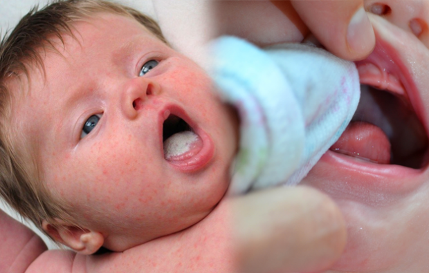 bebeklerde ağız yarası nasıl geçer