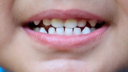 Çocuklara diş bakımı nasıl öğretilir?