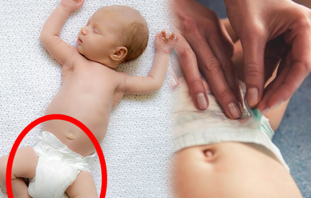 bebek bezi nasil baglanir bebek bezi sizdirmasi neden olur bebek bezinde sizdirma nasil onlenir