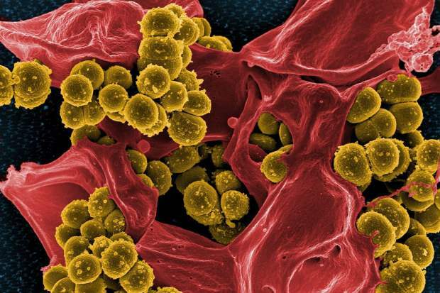 mers virüsü toplu alanlarda hızla yayılır