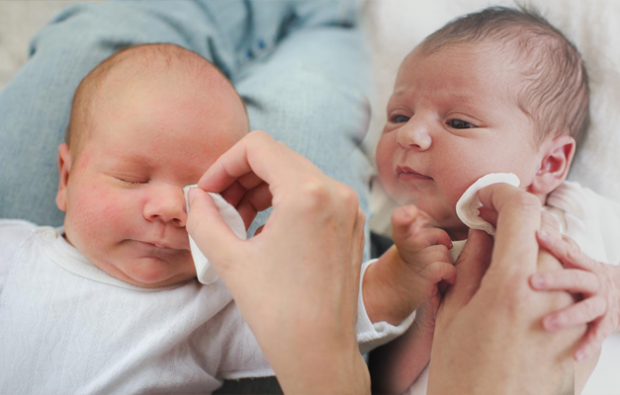 Bebeklerde çapak nasıl temizlenir? Bebeklerde göz çapaklanması neden olur? Anne sütü ile çapak masajı