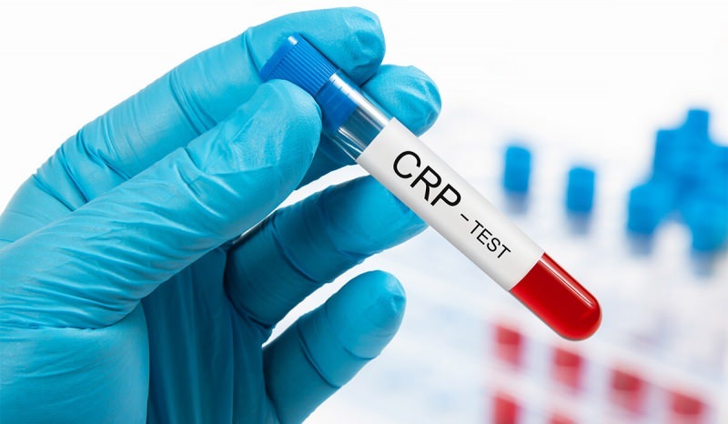 Kandaki CRP neden yükselir? CRP nedir? CRP nasıl düşürülür?