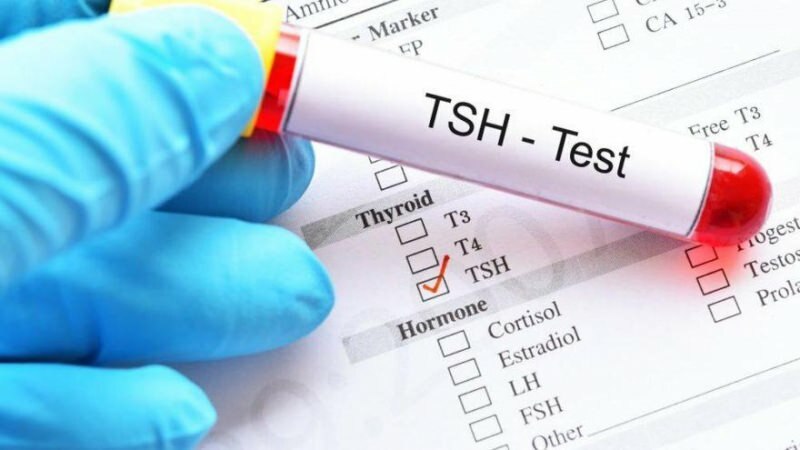 tsh testi hormon testidir