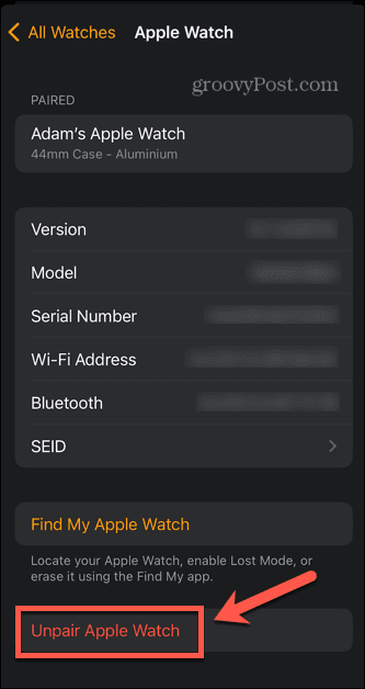 Apple Watch'ın eşlemesini kaldıran uygulamayı izle
