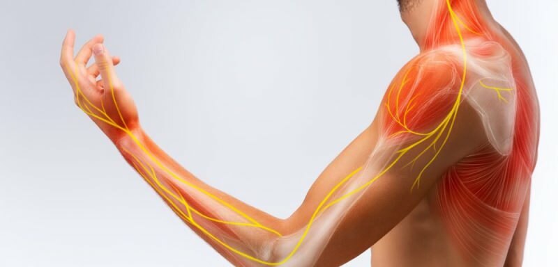 sinir sisteminde oluşan bir hasar sol kolda uyuşmaya neden olabilir