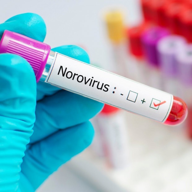 norovirüsü nedir ve hangi hastalıklara neden olur
