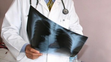 Uzmanlar açıkladı! Akciğer kanseri ölümlerinde artış