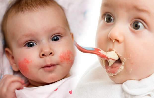 bebeklerde alerji belirtileri