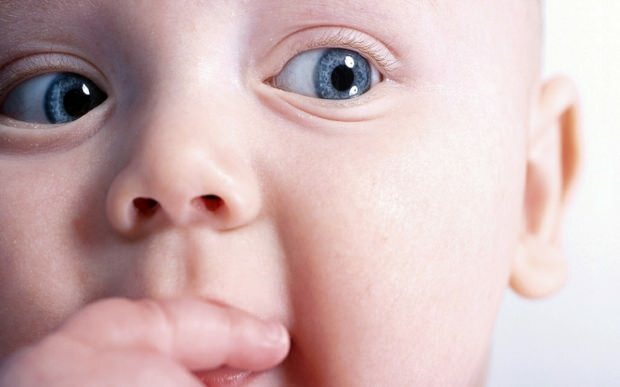 Bebeklerde göz kayması neden olur?