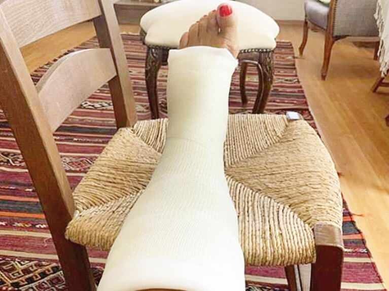 Usta sanatçı Ayşe Kökçü ayağını kırdı