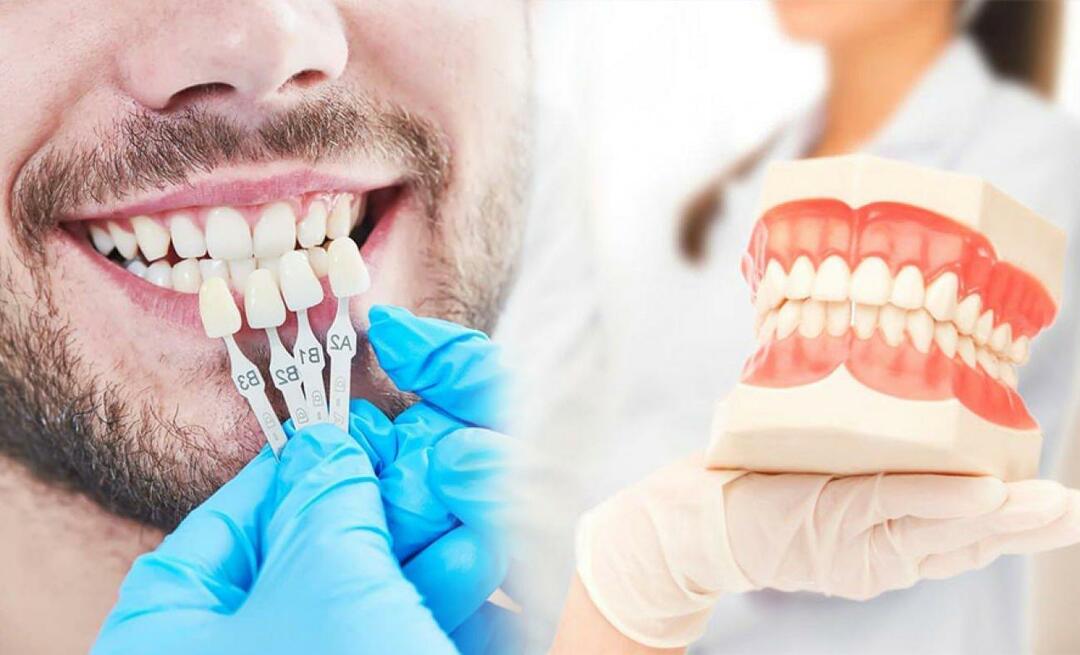 Dişlere zirkonyum kaplamalar neden yapılır? Zirkonyum kaplama ne kadar dayanıklıdır?