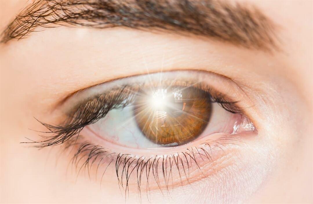 Gözde ışık çakması neden olur ve nasıl tedavi edilir?