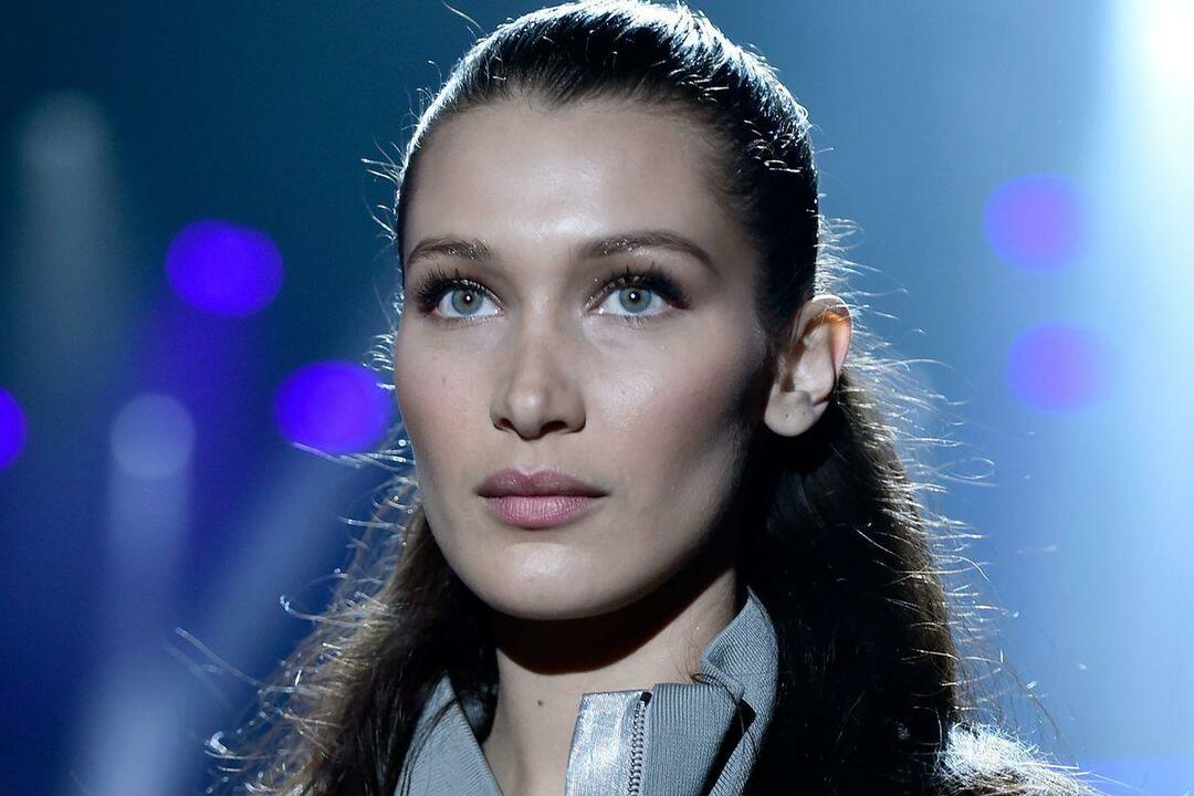 Bella Hadid'in hastalığı yüzünden vücudu morardı!