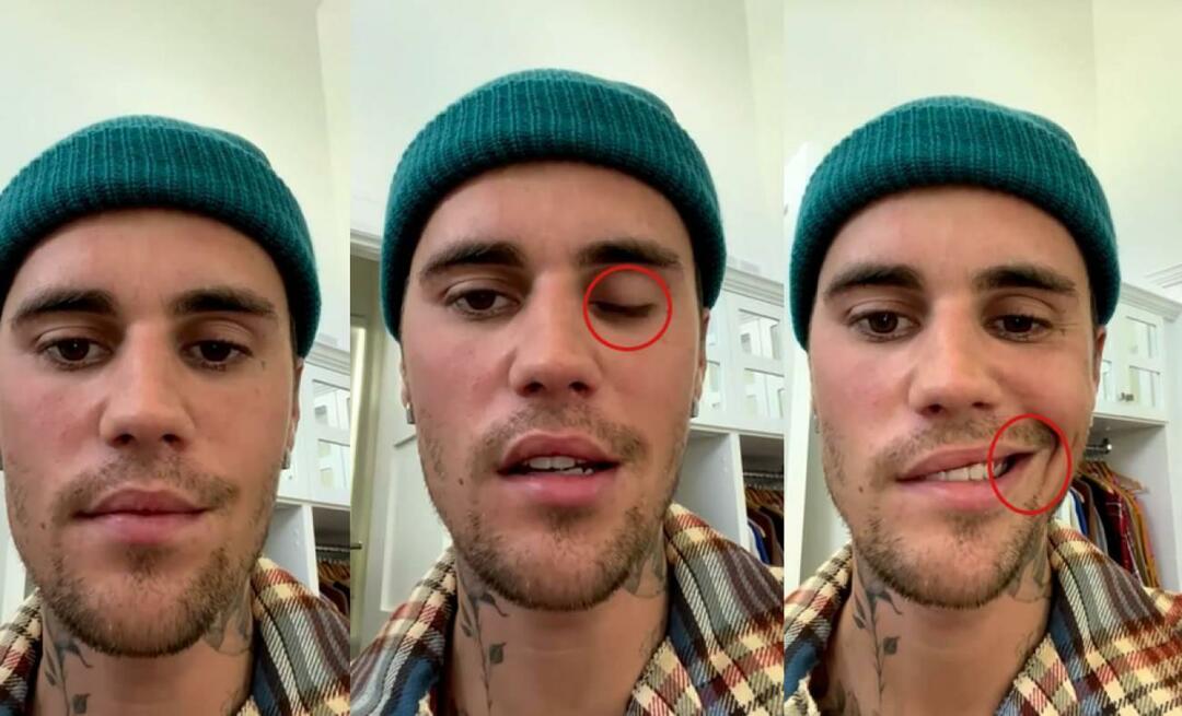 Justin Bieber yüz felci geçirmişti! Ünlü yıldız bir kez daha dünya turnesine çıkamıyor