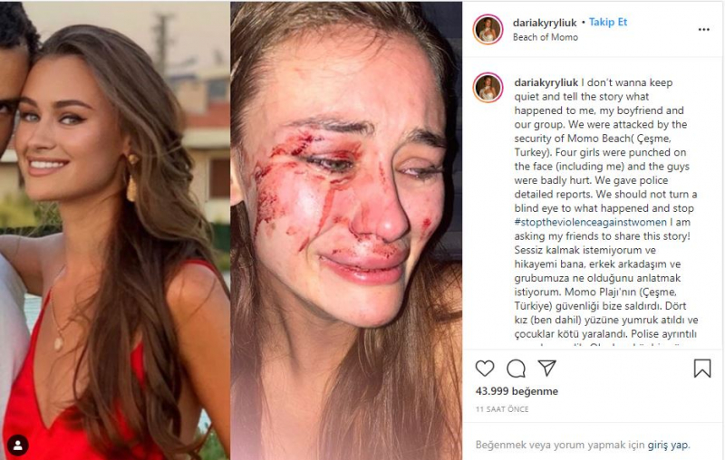 İzmir Çeşme'de darbe edildiği iddia edilen Ukraynalı top model Daria Kyryliuk ilk defa konuştu!